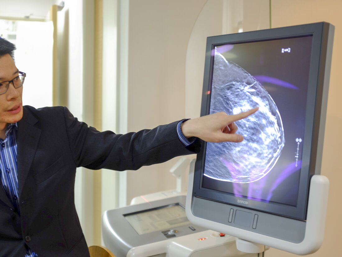 A doctor shows what a 3D image of the breast using tomosynthesis (3D mammography) looks like on a screen.