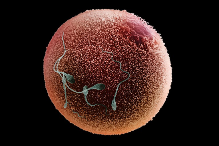 False-coloured scanning election micrograph of a human spermatozoa fertilising an egg