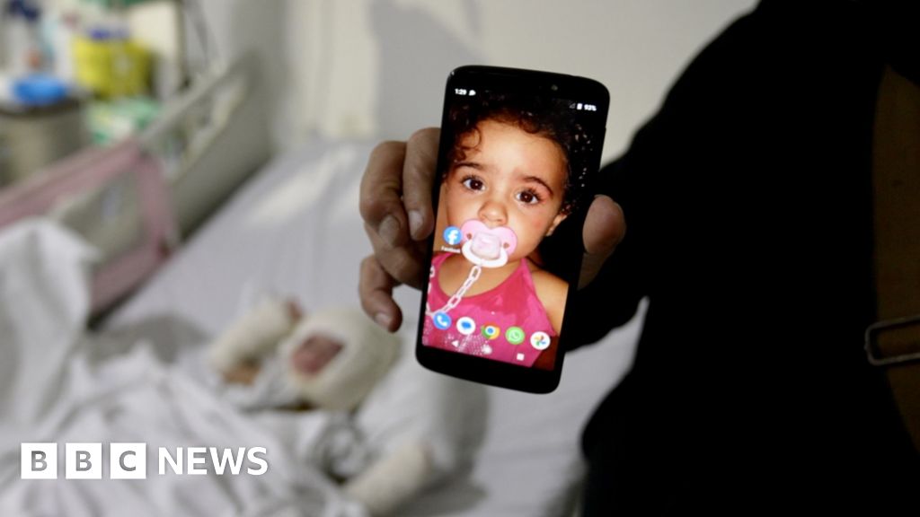 Lebanon: Father describes moment Israeli missile caused daughter's third-degree burns