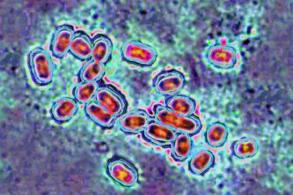 Pneumococcus (Streptococcus pneumoniae) is a bacteria involved in pneumonia, bronchopneumonia, purulent pleurisy, bacterial meningitis, otitis, sinusitis, and conjunctivitis. Image produced from optical microscopy.