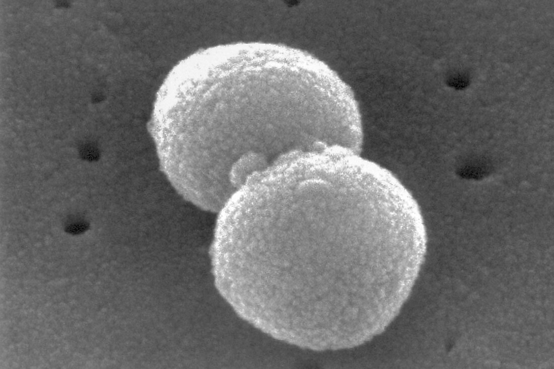 This electron microscopic image provided by the Centers for Disease Control and prevention depicts two, round-shaped, Gram-positive, Streptococcus pneumoniae bacteria.