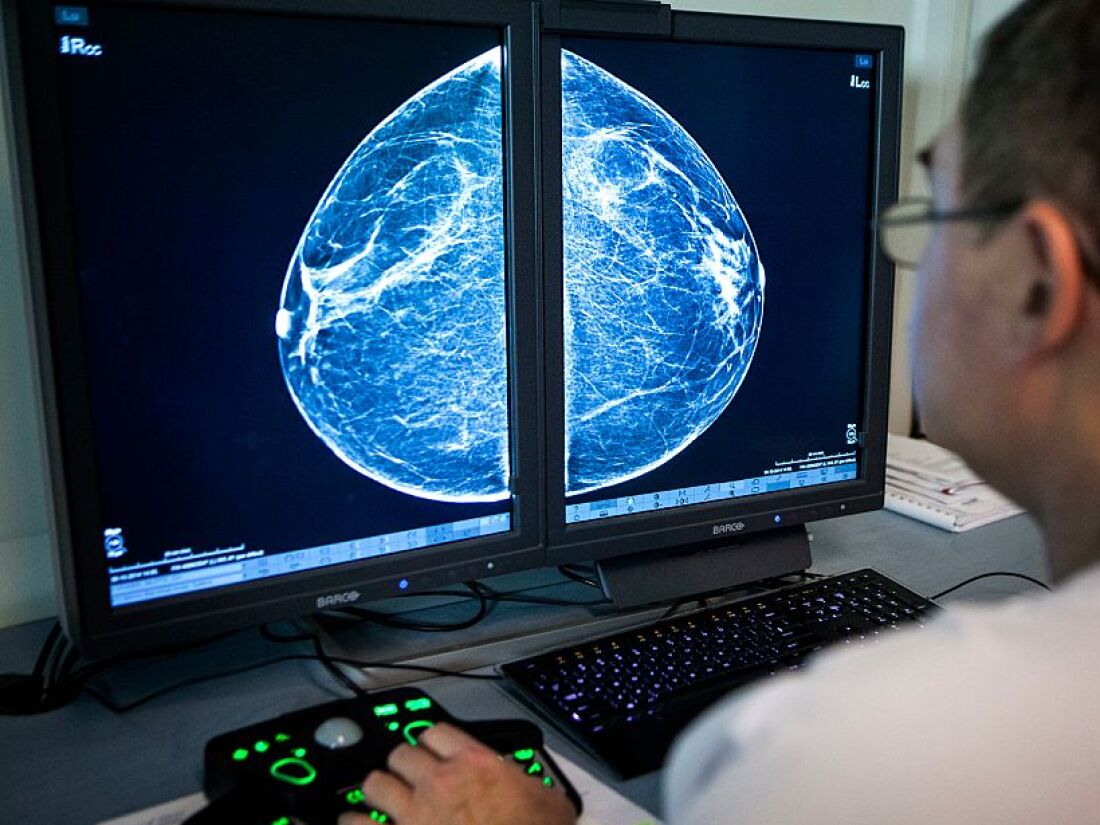 When radiologists review mammograms for signs of breast cancer, they can also see arterial calcification in the breast, which is linked with cardiovascular disease risk.