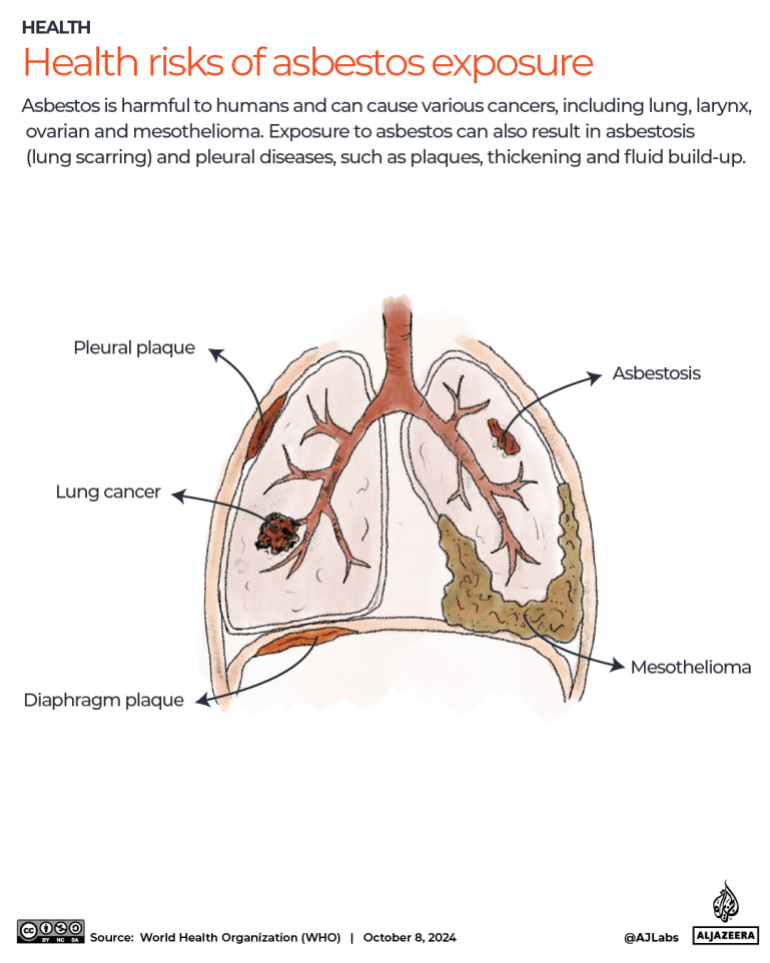 INTERACTIVE - Health Risks of Asbestos Exposure-1728378201